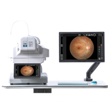 Eye Price Ophthalmology Equipment Non-mydriatic Automatic Fundus Camera